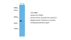 HOXD9 Rabbit anti-Human, Polyclonal, Novus Biologicals 0.1 mL | Buy Online | Novus Biologicals | Fisher Scientific